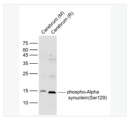 Anti-phospho-Alpha synuclein (Ser129) antibody-磷酸化核突触蛋白α抗体,phospho-Alpha synuclein (Ser129)