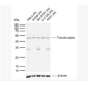 Anti-Tubulin-alpha antibody-微管蛋白α/Tubulin α（内参）抗体