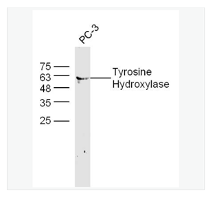 Anti-Tyrosine Hydroxylase antibody-酪氨酸羟化酶抗体