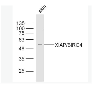 Anti-XIAP/BIRC4 antibody-X-连锁凋亡蛋白/性连锁凋亡抑制蛋白抗体,XIAP/BIRC4