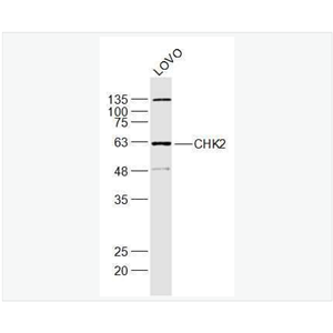 Anti-CHEK2 antibody-细胞周期检测点激酶2抗体