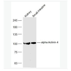 Anti-alpha Actinin 4 antibody-α-辅肌动蛋白4抗体