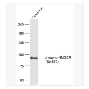 Anti-phospho-HMGCR antibody -磷酸化三羟基三甲基辅酶A还原酶抗体