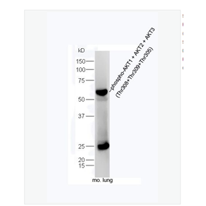 Anti-phospho-AKT1 + AKT2 + AKT3antibody -磷酸化蛋白激酶B抗体