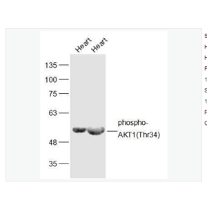 Anti-phospho-AKT1 antibody -磷酸化蛋白激酶B抗体