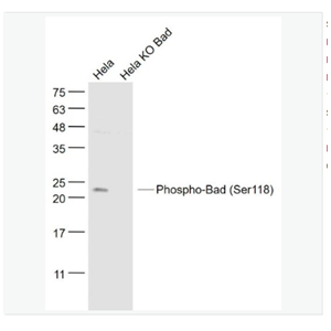 Anti-Phospho-Bad antibody -磷酸化相关死亡促进因子抗体,Phospho-Bad (Ser118)