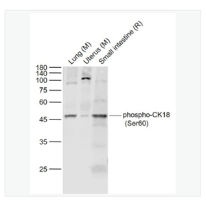 Anti-phospho-CK18antibody -磷酸化细胞角蛋白18抗体