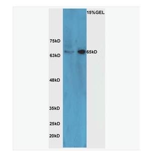 Anti-HRG beta 1 antibody -乳腺癌细胞分化因子P45抗体,HRG beta 1