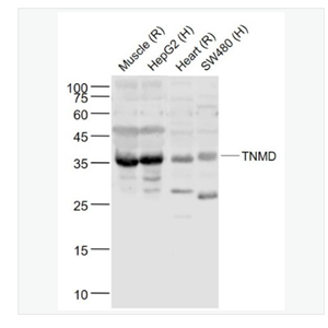 Anti-TNMD  antibody -腱调蛋白/软骨调节素样1蛋白抗体