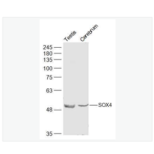Anti-SOX4  antibody -核转录因子SOX4抗体