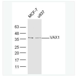 Anti-VAX1 antibody -視神經(jīng)視網(wǎng)膜相關(guān)蛋白VAX1抗體