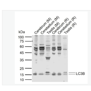 Anti-LC3B antibody-自噬微管相关蛋白轻链β3抗体