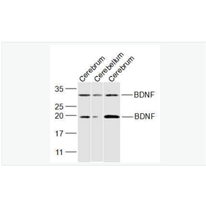 Anti-BDNF antibody-脑源神经营养因子抗体