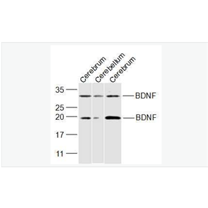 Anti-BDNF antibody-脑源神经营养因子抗体,BDNF