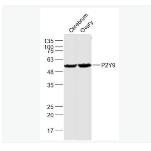 Anti-P2Y9 antibody-G蛋白偶联嘌呤受体p2y9抗体,P2Y9