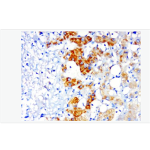 Anti-PSMD14 antibody-蛋白酶調(diào)解因子14抗體