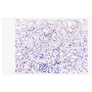 Anti-phospho-Smad2 (Ser467) antibody-磷酸化细胞信号转导分子SMAD2抗体