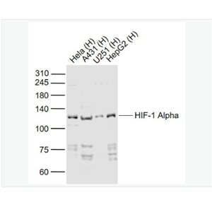Anti-HIF-1 Alpha antibod-缺氧诱导因子1α /HIF-1α抗体