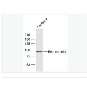 Anti-Beta catenin antibody-β-连环蛋白/β-连环素/β链接素抗体