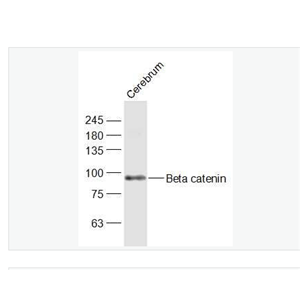 Anti-Beta catenin antibody-β-连环蛋白/β-连环素/β链接素抗体,Beta catenin