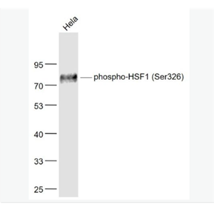 Anti-phospho-HSF1 (Ser326) antibody-磷酸化热休克因子1重组兔单克隆抗体