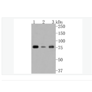 Anti-Phospho-PKC alpha (Thr638) antibody-磷酸化蛋白激酶C α/β2重组兔单克隆抗体
