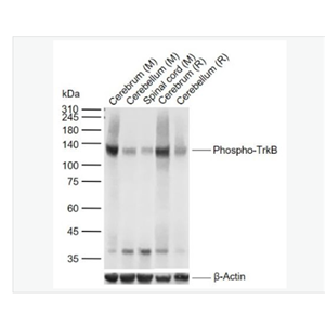 Anti-Phospho-TrkB (Tyr817) antibody-磷酸化酪氨酸激酶B(Tyr817)重组兔单克隆抗体