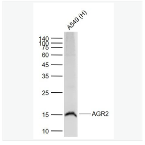 Anti-AGR2 antibody-前梯度同源蛋白2重组兔单克隆抗体