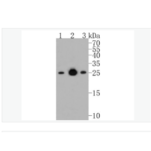 Anti-Bcl-2 antibody-Bcl-2重组兔单克隆抗体