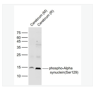 Anti-TFRC antibody-转铁蛋白受体（CD71）重组兔单克隆抗体