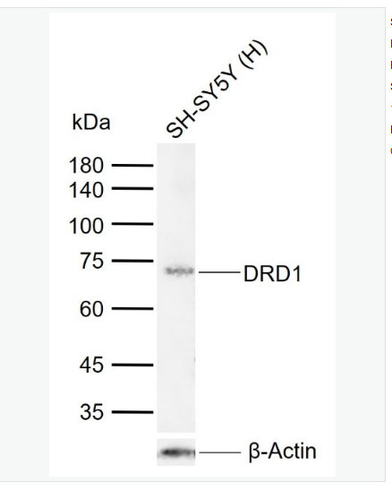 Anti-DRD1 antibody-多巴胺受体D1重组兔单克隆抗体,DRD1