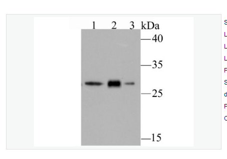 Anti-GCLM  antibody-GCLM重组兔单克隆抗体,GCLM