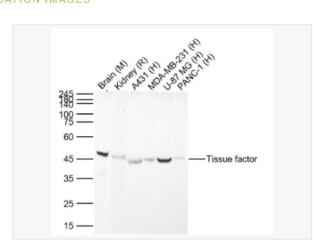 Anti-Tissue factor  antibody-组织因子（CD142）兔单克隆抗体,Tissue factor