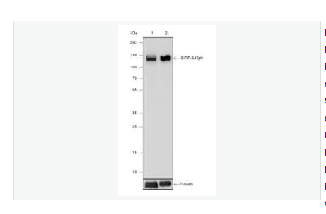 Anti-Phospho-SIRT1  antibody-磷酸化沉默调节蛋白1重组兔单克隆抗体,Phospho-SIRT1 (Ser47)