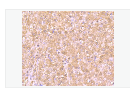 Anti-PSMB8 antibody-中文名称蛋白酶体20S亚基LMP7重组兔单克隆抗体,PSMB8