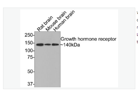 Anti-Growth hormone receptor  antibody-生长激素受体抗体,Growth hormone receptor