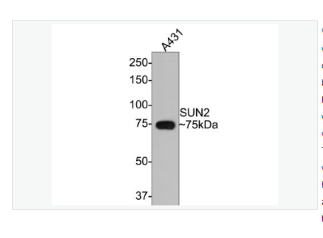 Anti-SUN2antibody-SUN2重组兔单克隆抗体,SUN2