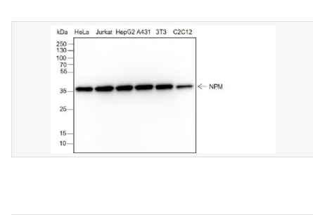 Anti-Nucleophosmin antibody-核仁磷酸蛋白重组兔单克隆抗体,Nucleophosmin