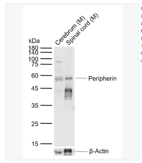 Anti-Peripherin antibody-外周蛋白抗体,Peripherin