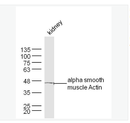 Anti-alpha smooth muscle Actin  antibody-肌动蛋白α/α-SMA/α Actin抗体,alpha smooth muscle Actin