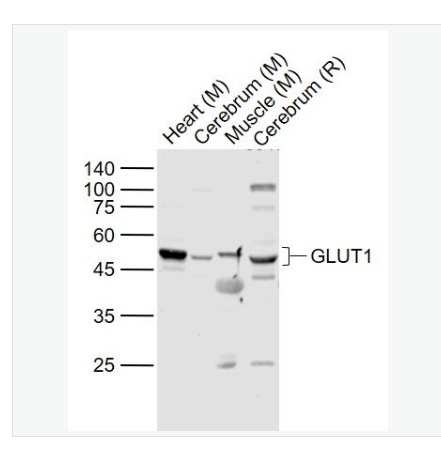 Anti-GLUT1  antibody-葡萄糖转运蛋白1抗体,GLUT1