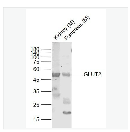 Anti-GLUT2 antibody-葡萄糖转运蛋白2抗,GLUT2