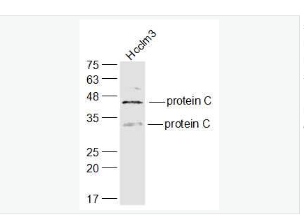 Anti-protein C  antibody-維生素K依賴的蛋白C重鏈抗體,protein C