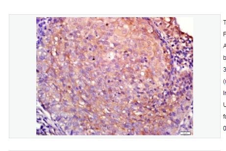 Anti-Aquaporin 4   antibody-水通道蛋白4抗体,Aquaporin 4