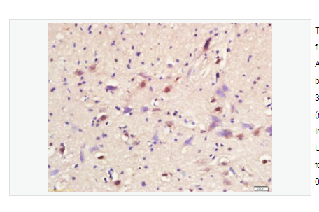 Anti-ASCL1 antibody-神经母细胞特异性转移因子抗体,ASCL1