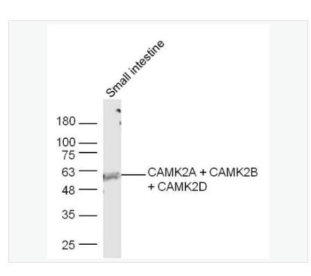 Anti-CAMK2A + CAMK2B + CAMK2Dantibody-钙/钙调素依赖蛋白激酶2b/2γ抗体,CAMK2A + CAMK2B + CAMK2D