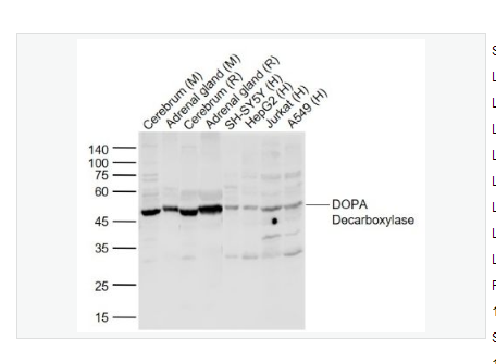 Anti-DOPA Decarboxylase antibody-多巴胺脱羧酶抗体,DOPA Decarboxylase