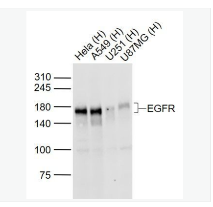 Anti-EGFR antibody-表皮生长因子受体抗体,EGFR