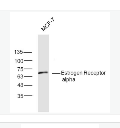 Anti-Estrogen Receptor alpha antibody-雌激素受体α抗体,Estrogen Receptor alpha