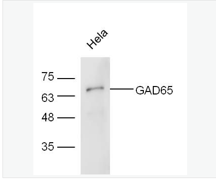 Anti-GAD65 antibody-谷氨酸脱羧酶-65抗体,GAD65